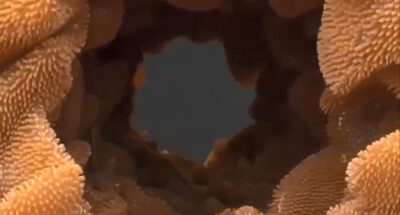 Кишечные ворсинки — махровая поверхность нашего кишечника